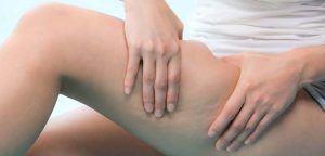Combattre la cellulite avec du vinaigre de cidre.